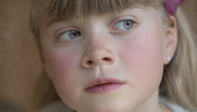 Allergies In Children