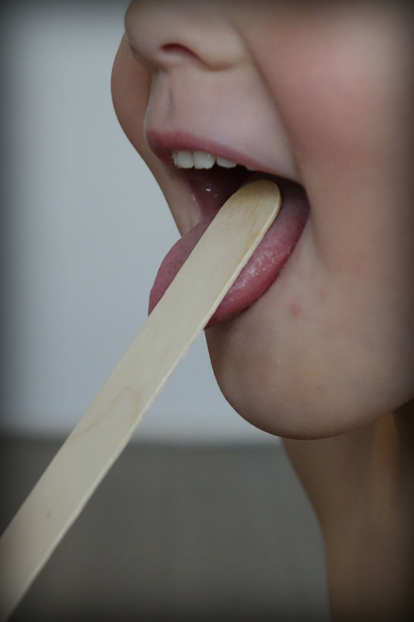 Cold Sores
