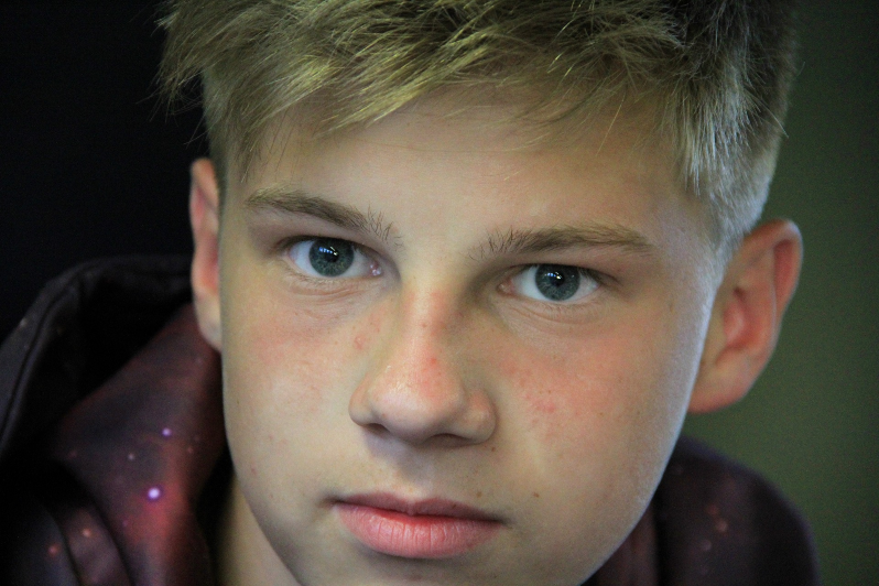 Teen Acne: What It Is And What To Do About It
