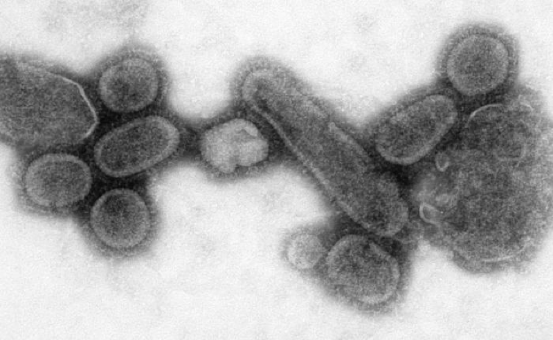 What is Influenza